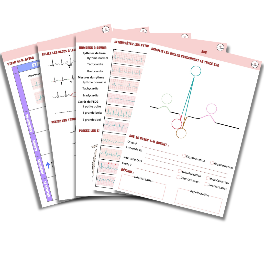 Exercices ECG
